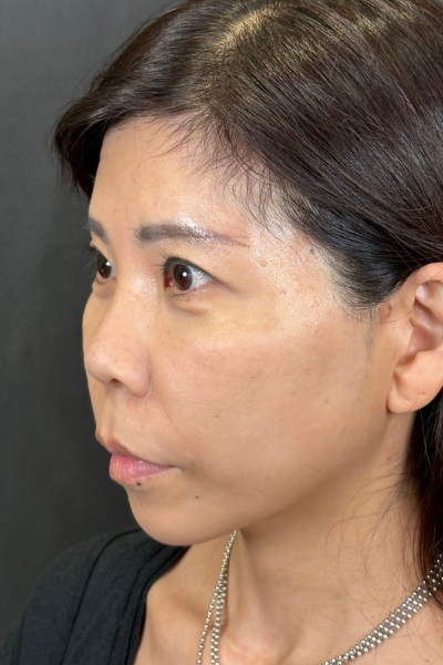 手术前的状态 其一