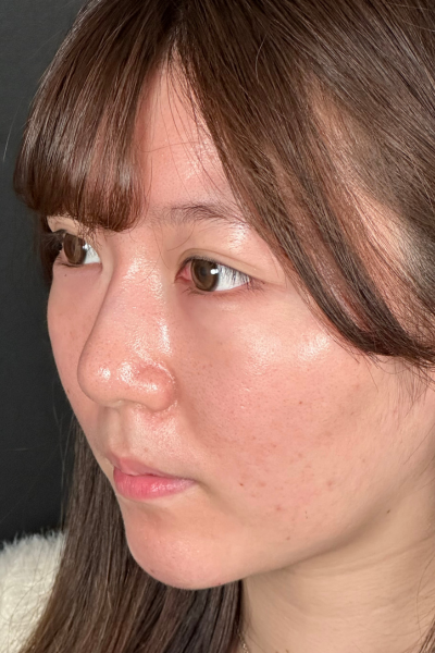 手術前の状態 その1