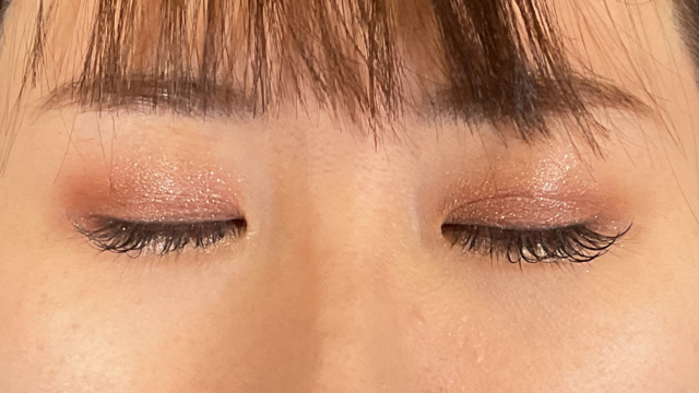 手术前的状态 其一