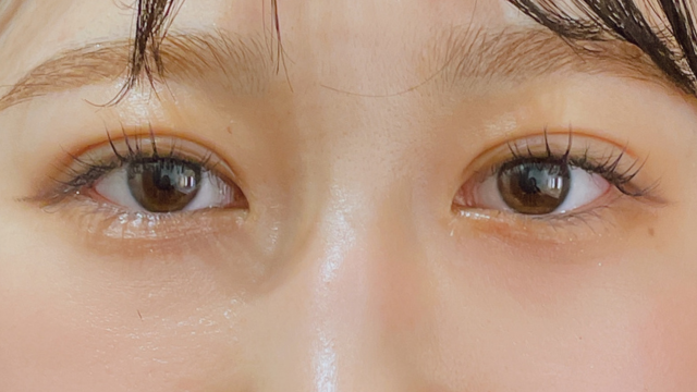 手术前的状态 其一