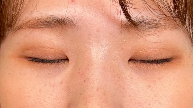 手术前的状态 其一