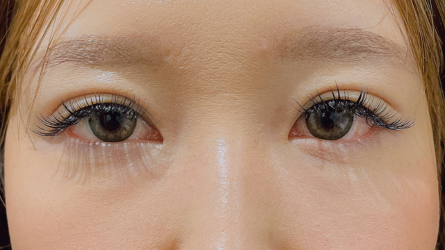 手术前的状态 其一