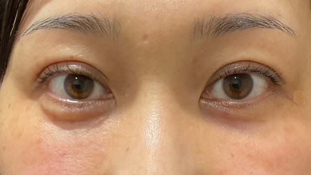 手术前的状态 其一