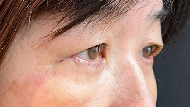 Postoperative Condition Part 1