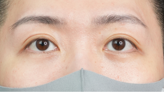 手术前的状态 其一