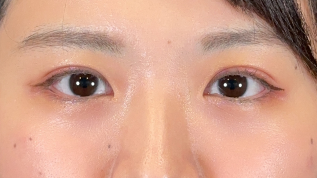 Postoperative Condition Part 1