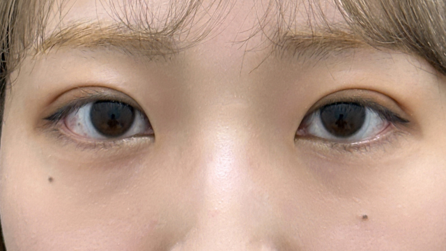 手术前的状态 其一