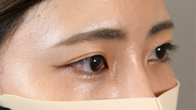 Postoperative Condition Part 1