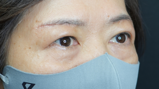 Postoperative Condition Part 1