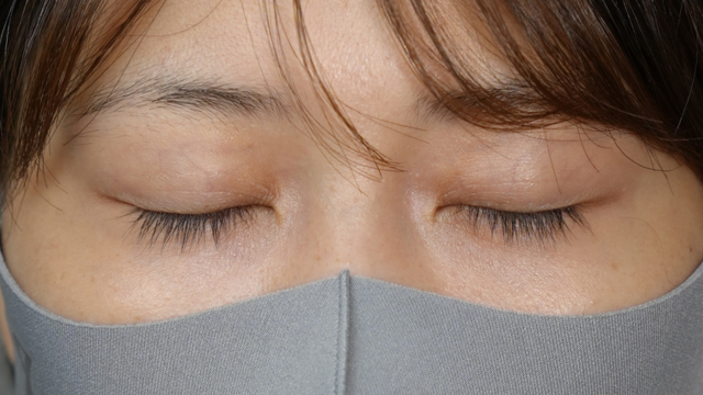 Postoperative Condition Part 1