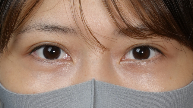 Postoperative Condition Part 1