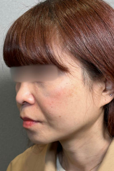 Postoperative Condition Part 1