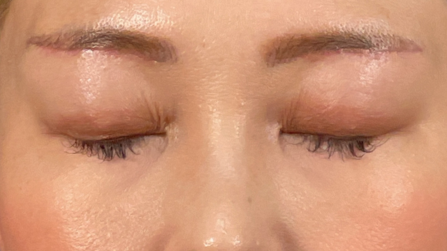 Postoperative Condition Part 1