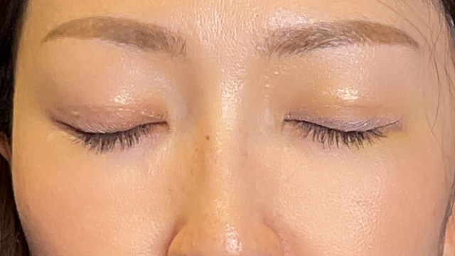 手术前的状态 其一