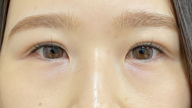 手术前的状态 其一