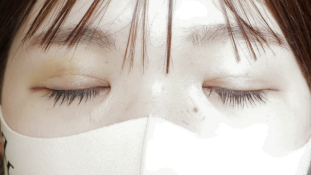 手术前的状态 其一