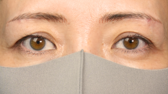 Postoperative Condition Part 1