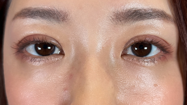 手术前的状态 其一