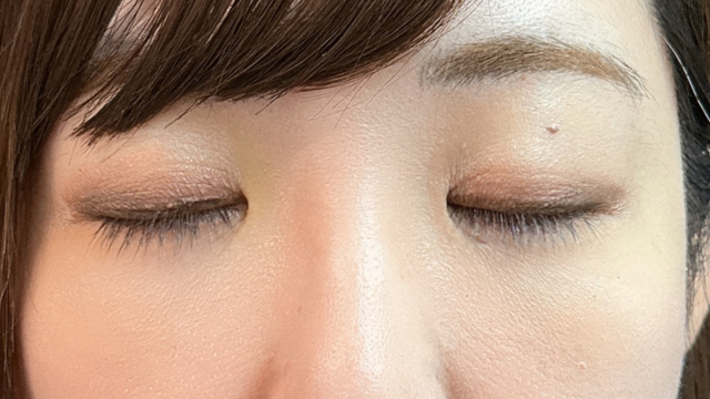 手术前的状态 其一