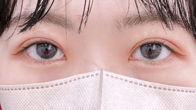 手術前の状態 その1