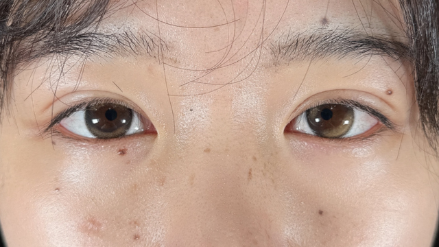 手术前的状态 其一