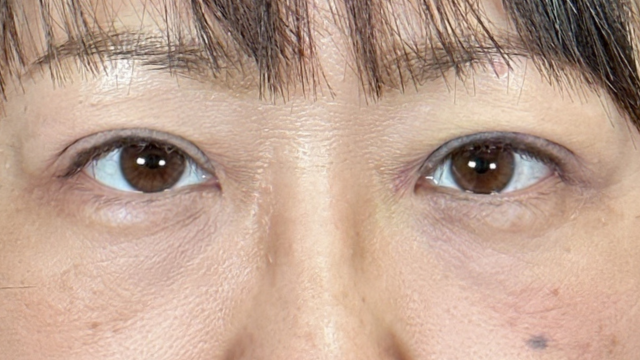 Postoperative Condition Part 1