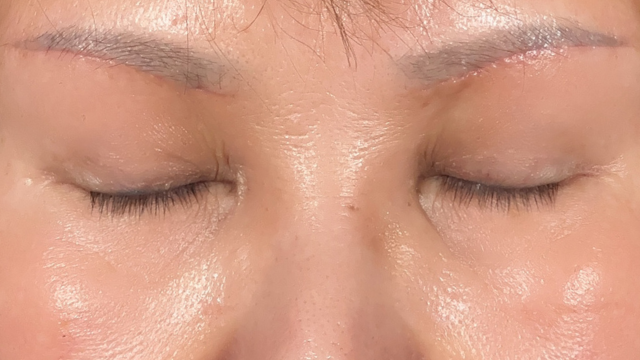 Postoperative Condition Part 1