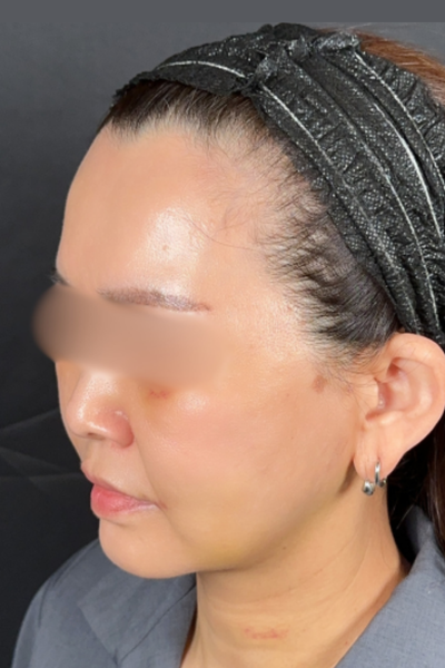 手術前の状態 その1