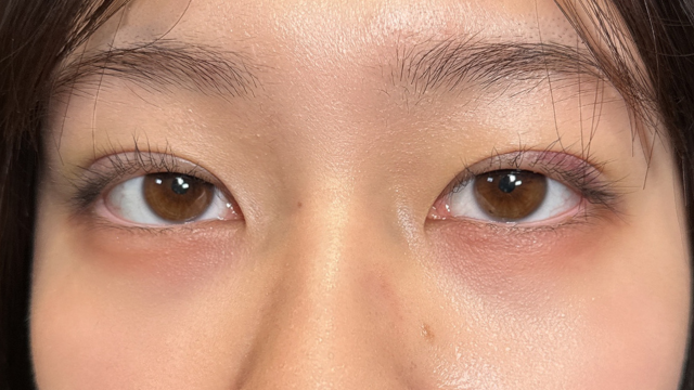 手术前的状态 其一