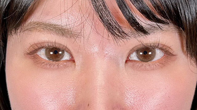 手術前の状態 その1