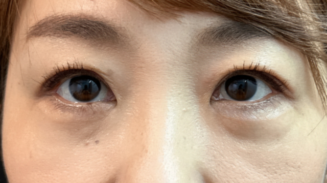 Postoperative Condition Part 1