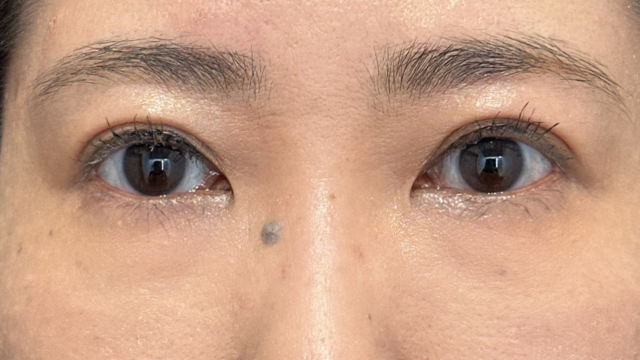 Postoperative Condition Part 1