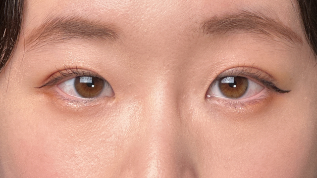 Postoperative Condition Part 1