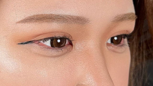 手术前的状态 其一