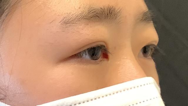 Postoperative Condition Part 1