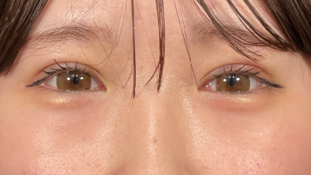 Postoperative Condition Part 1