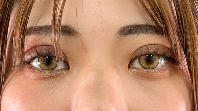 Postoperative Condition Part 1