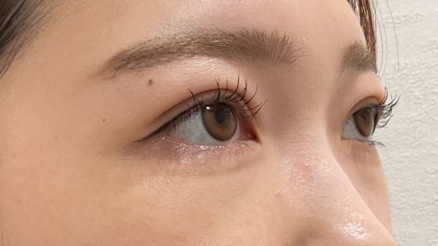 Postoperative Condition Part 1