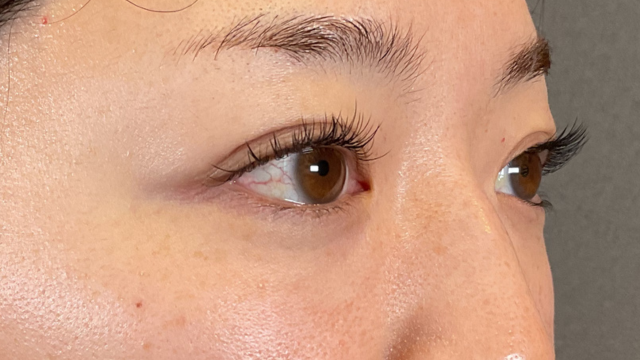 手术前的状态 其一