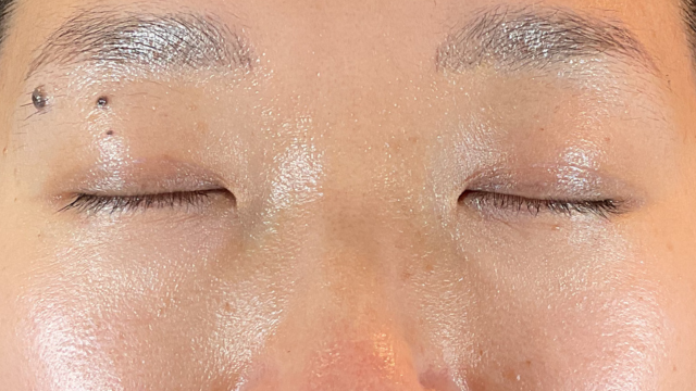 Postoperative Condition Part 1