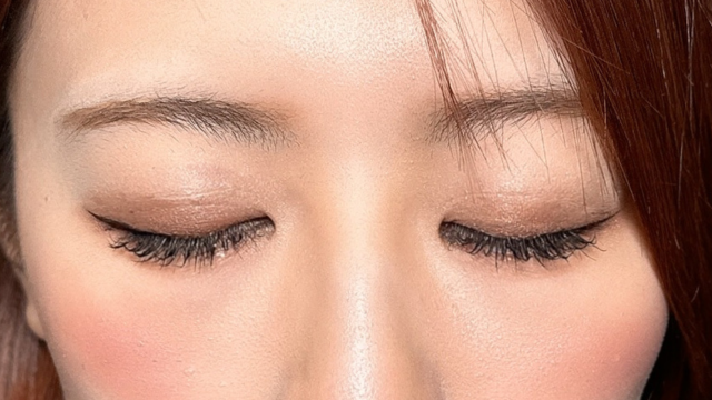 手术前的状态 其一