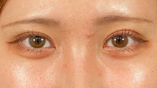 手术前的状态 其一