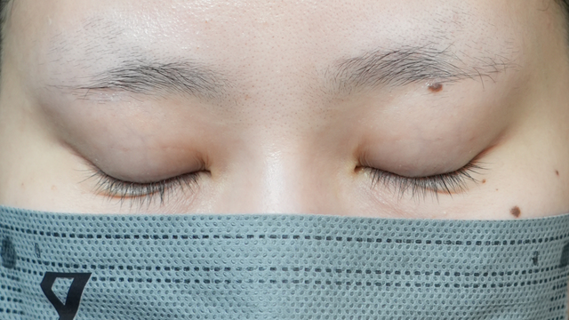 Postoperative Condition Part 1