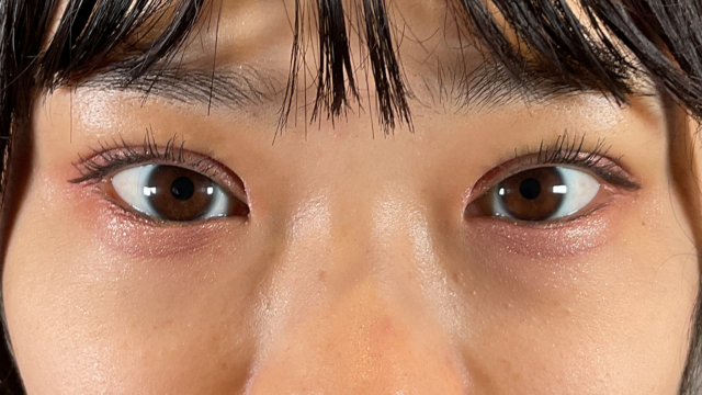 手术前的状态 其一