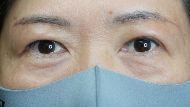 Postoperative Condition Part 1