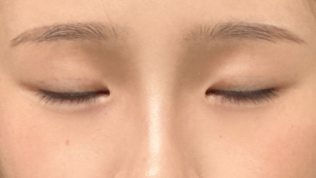 手术前的状态 其一