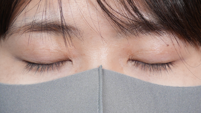 手术前的状态 其一