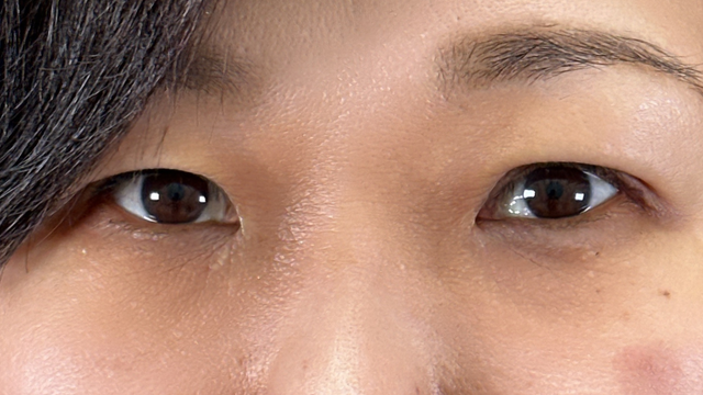 Postoperative Condition Part 1