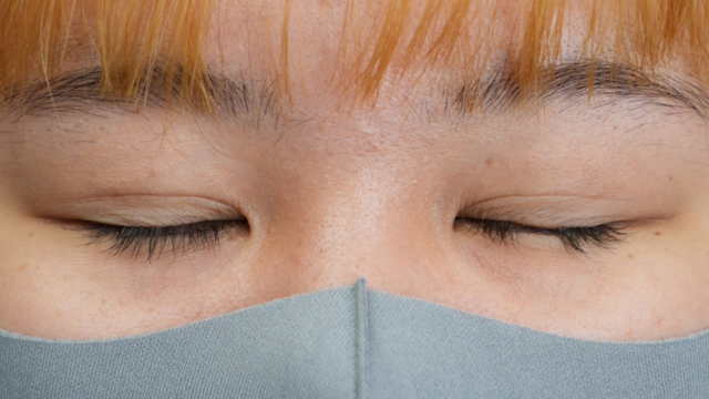 手术前的状态 其一