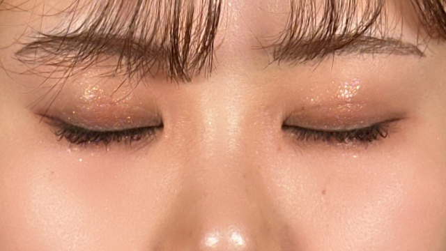 手术前的状态 其一